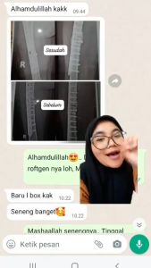 Nutrient Calcium Powder | Susu Patah Tulang | Susu Fraktur Tulang | Susu Osteoporosis | Susu Peninggi Badan