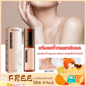 EELHOE ครีมบํารุงผิวคอ ต่อต้านริ้วรอย 50 กรัม มอบความชุ่มชื้น กระชับ และเปล่งประกาย