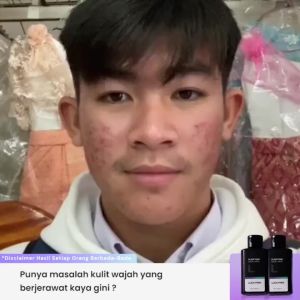 Sabun Wajah Pembersih Jerawat LUCKYMEN Purifying Facial Wash - Sabun Wajah Muka Glowing Pria Jerawat Dan Bekas Jerawat
