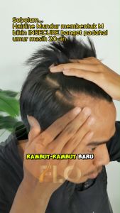 Penumbuh Kebotakan Rambut Pria Berbentuk M Instan - Flo Hair Tonic 60ml