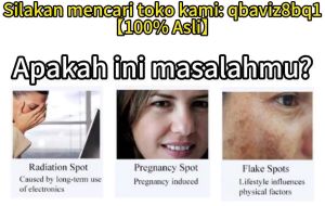 Whitening and Spot Removing Cream  Freckle removing cream 祛斑黄褐斑霜 20g Remove spots  Moisture  Brighten the skin