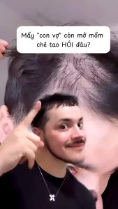 Dầu gội Loreal Serioxyl Scalp Advanced làm dày và phồng tóc mỏng thưa rụng New 1500ml