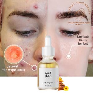 Essence Moisturizing & Propolis Serum: Solusi Anti Acne & Anti Inflamasi