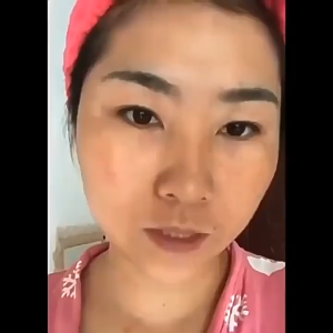 Serum Penghapus Bintik Hitam 5ml | 去斑精华液5ml | Dark Spot Removal Serum 5ml