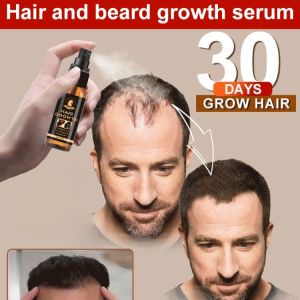 Biotin Hair Growth Spray Fast Growing Anti Hair Loss Hair Care Essential Oil Repair Damaged Hair Strengthen Hair Root