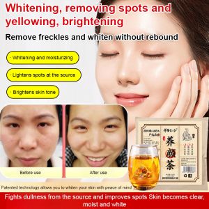 Beauty Detoxification And Skin Care Tea Internal Regulation Of Spot Removal Spot Whitening And Yellowing Spots Chinese Medicine Health Care Regulating Qi And Blood Endocrine草本萃取祛斑养颜茶