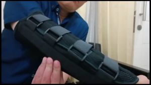 Braket Siku Stainless Steel & Sindrom Tunnels Kubital: Penanganan Cidera Lengan