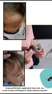 penumbuh rambut bayi minyak byeolde kids hair oil 60ml