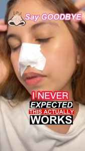 Lanbena Blackhead Whiteheads Remover Mask Facial Peeling Nose Strip Acne Deep Cleansing 30g