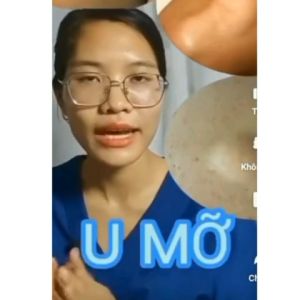 South Moon Kem Loại Bỏ Lipoma Lipolysis Kem tan u mỡ loại bỏ u mỡ hiệu quả kem loại bỏ u sưng phù sơ vữa đến 99% tinh chất thảo dược thiên nhiên giúp da khỏe thẩm mỹ cam kết hiệu quả