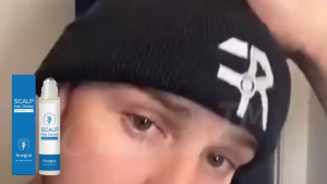 Hoegoa Rosemary Hair Care Roll-on Essence Roll-on Massage Scalp Care Hair Care Smooth Impressive Soft