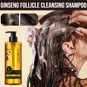Ginseng Follicle Cleansing Shampoo Deep Scalp Cleaning Shampoo Oil Control Anti-Dandruff