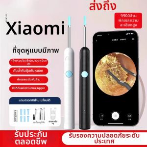 Công Cụ Loại Bỏ Sáp Tai Không Dây Có Camera