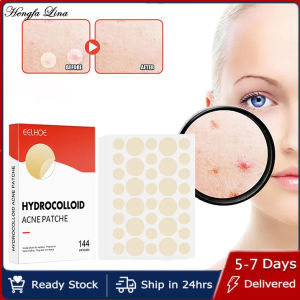 Hengfa Lina 144pcs Face Skin Care Acne Pimple Patch 2 Sizes Invisible Professional Healing Absorbing Spot Sticker Covering for Men Women
