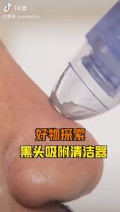 Máy Hút Mụn Cầm Tay Làm Sạch Da Mặt Hút Các Loại Mụn Làm Sáng Da Tiện Lợi 2 Loại Pin Và Sạc Điện