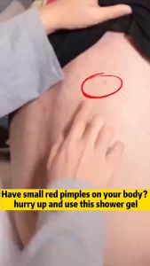 Acne body wash Gel mandi Sabun Whitening Menghilangkan tungau dan jerawat Pemutih kulit Whitening Body Wash 400ml