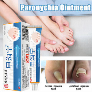 paronychia pain relief anti fungal cream ingrown toenail corrector swelling inflammation nail care analgesic