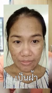 สบูไวเทนนิ่ง เฟเซี่ยน โซบ& มอยส์เจอร์ไรเซอร์ครีมTimess WOW