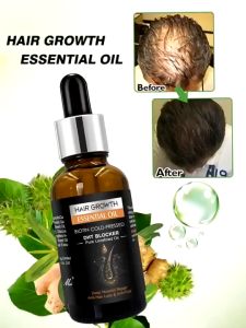 Serum mọc Tóc Thảo Dược DHT Blocker Kích Thích Mọc Tóc Giảm Gãy Rụng Dưỡng Tóc Chắc Khoẻ 30ml
