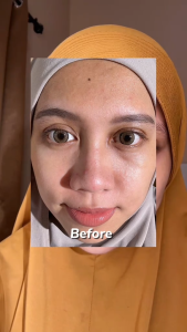 Reglow Paket Flek Hitam Dan Noda Hitam - Isi 4 - Paket Lengkap dengan Serum Perfect Glowing