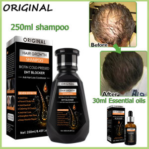 🔥การจัดส่งภายในประเทศ + มีสินค้า🔥ครีมนวดผมกระชับผมร่วงอัด Sampo Penumbuh Rambut น้ำมันหอมระเหยไบโอตินสำหรับการเจริญเติบโตของเส้นผม