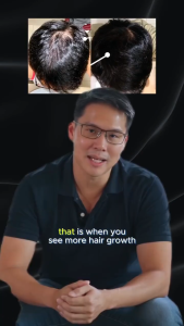 (6.9K sold) MIRIQA® Hair Growth Capsules - 1 Box (60pcs) 1/Day Biotin/Saw Palmetto Anti-Hair Loss/Root Strengthen/Growth/Scalp Circulation/Hair Nourishment/Dry Hair Improvement