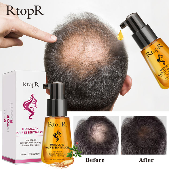 RtopR FDA Moroccan Prevent Hair Loss Product Hair Growth Essential