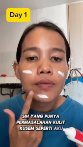 Chalonese Whitening Cream dan Menyamarkan Flek Hitam Wajah BPOM original