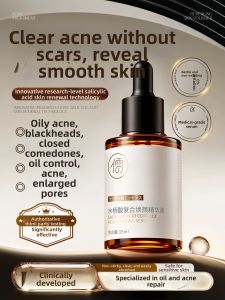 RUYI | Acne Treatment and Scar Fading Essence