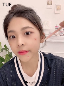 K-SECRET OIL & ACNE CONTROL SET (Calamine Serum + Cream)