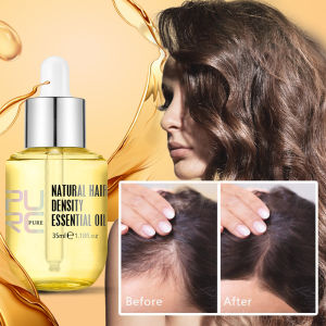 Hailicare Ginger Hair Growth Serum 30ml Hair Thickening Essential Oil Natural Anti Hair Loss Promote Hair Regrowth Moisturizes Repair Hair Roots Repairs Damaged Hair Nutirents