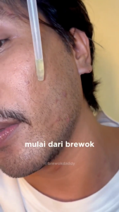 Serum Penumbuh Rambut Original 5% Minox | Penumbuh Rambut Kebotakan Alis Brewok |𝐏𝐑𝐎𝐌𝐎 𝐂𝐔𝐂𝐈 𝐆𝐔𝐃𝐀𝐍𝐆
