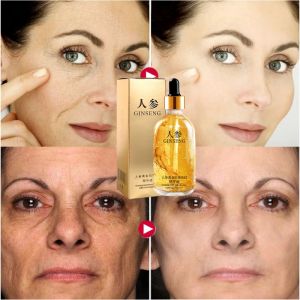 Hot sale pati anti kedut ginseng peptide serum anti penuaan niacinamide mousturizer lifting firming original skincare ready stock100ml人参精华液烟酰胺