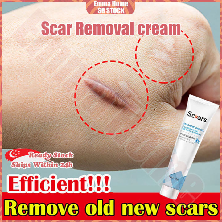 Light Wrinkle Reduction and Acne Treatment Panel - McKesson - Acne Treatment For Acne On Calves