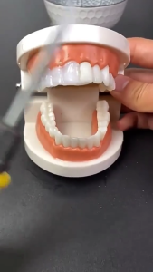 Tambal Gigi 2.000 Butir Authentic Lepas Pasang