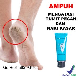 Obat Kaki Pecah dan Kering Ampuh BPOM Asli Foot & Heel Cream Perawatan Penghalus Telapak Mengatasi Tumit Kapalan Krim Penghilang Pecah2 Parah Langsung Mulus Secara Instant Paling Cepat Ajaib Original Viral di Tiktok A30
