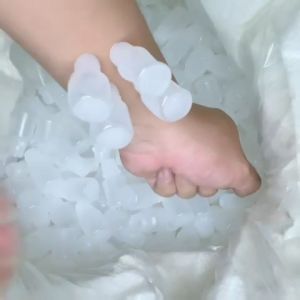 Ống nhựa hút mụn 5ml ( túi 100 ống ) lọ hút mụn mủ máu bầm loại 1 siêu dày lực hút mạnh có thể tái sử dụng ống hút máu mụn spa