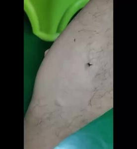 [OL] Epilator Alat Penghilang Bulu Kaki Epilator Hair Remover Pembersih Kulit Mati Bulu Ketiak