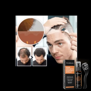 West&Month Hair Care Essence Spray with Derma Roller 30ml – with Polygonum Multiflorum & Ginger Nourishes Scalp & Hair Roots Helps Improve Thicker-Looking Hair & Beard Daily Scalp Care for Men & Women