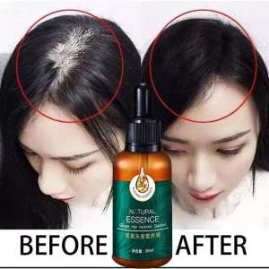 Esensi pertumbuhan serum rambut/minyak rambut 30mlmeningkatkan pertumbuhan rambut cepat /anti-rambut rontok/agen penumbuh rambut/Obat penumbuh Rambut Tanaman/Rambut Penumbuhan Alopecia /Esensi/pertumbuhan rambut Prevents Baldne