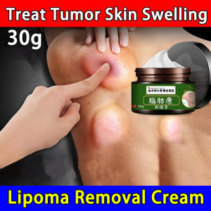 Megumi Beauty Care Skin Tools Remove Lipoma 30g Natural Ingredients Improve Lipoma Special Tools Moisturize Skin
