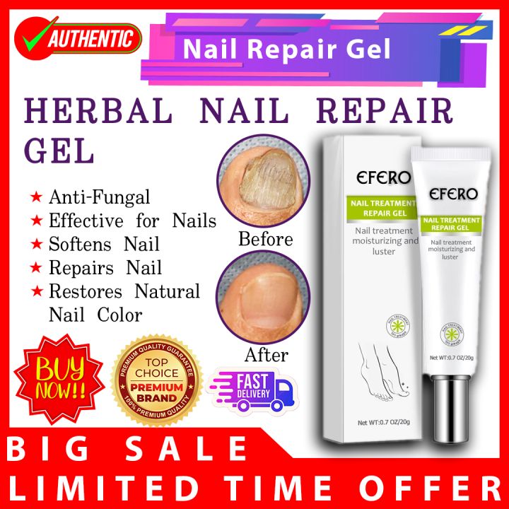 EFERO Nail Treatment Fungal Nail Fungus Treatment Cream Anti Fungal Nail Repair Gel Anti Fungus