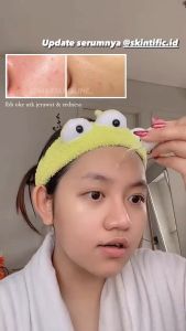 SKINTIFIC 2% Salicylic Acid Anti Acne Serum 20ml Serum Jerawat Melembabkan wajah Facial Serum
