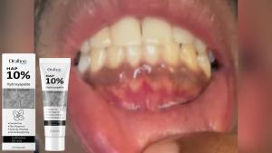 oralhoe | Oralhoe Hydroxyapatite Toothpaste 10% Hap Fresh Breath Oral Care Strengthening Enamel Repair for Teeth Whitening Toothpaste 120g