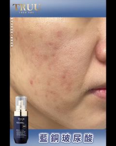 TRUU Copper Peptide Hyaluronic Hydrating Repair Essence+76 Probiotics Amino Puri 藍銅玻尿酸保濕修復精華+ 76酵母胺基酸淨膚潔顏露