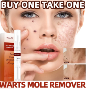 Jaysuing Professional Warts Papillomas Verruca Removal Liquid Pen 3ml 100% Original Fast Acting Formula for Hand Foot Warts Kutil Cholesterol Seed Skin Tags Elimination Effective Moles Remover with Smooth Skin Recovery for All Skin Types