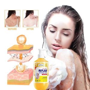 Anti Itching Antimicrobial SADOER Sulphur Body Wash oil control Sulfur Anti jerawat bacterial body wash 500ml deep cleansing of skine SADOER硫磺沐浴露