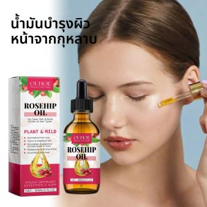 น้ำมันบำรุงผิวหน้าโรสฮิป 60 มล. เนื้อบางเบา สำหรับผิวแห้ง ผสมไฮยาลูรอนและวิตามินอี เซรั่มซึมซาบเร็ว สำหรับผิวขาดน้ำ ไม่ก่อให้เกิดสิว