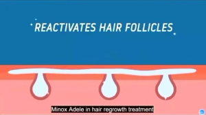 Minoxidil Strands 6% Minoxidil Topical Solution 60ml Hair Grower Beard Grower Eyebrow Growth Agent Effectively Inhibits Hair Loss And Promotes Hair Growth And Oil Control Spray