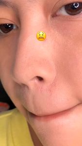 SKINTIFIC Alaska Volcano Pore Clay Stick 40 gr